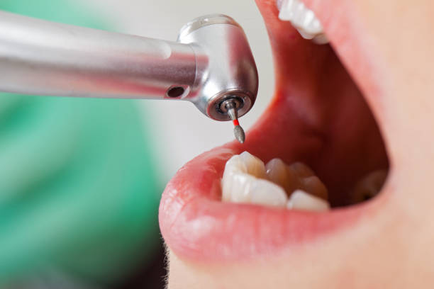 Best Broken Tooth Emergency  in Johnson City, TX